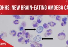 New brain-eating amoeba case in NC: What you need to know
